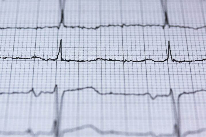 Czujnik oparty na sztucznej inteligencji pozwoli monitorować niewydolność serca