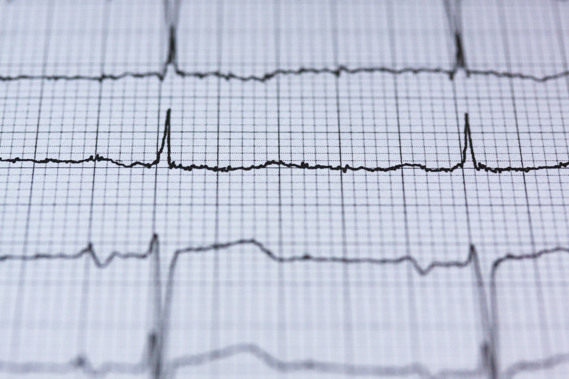 Czujnik oparty na sztucznej inteligencji pozwoli monitorować niewydolność serca