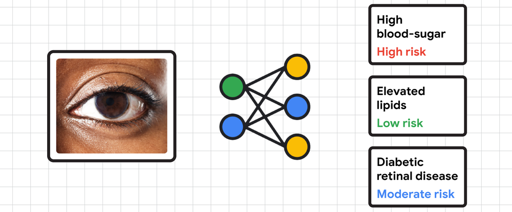AI Google Health analiza zdjęcia oka