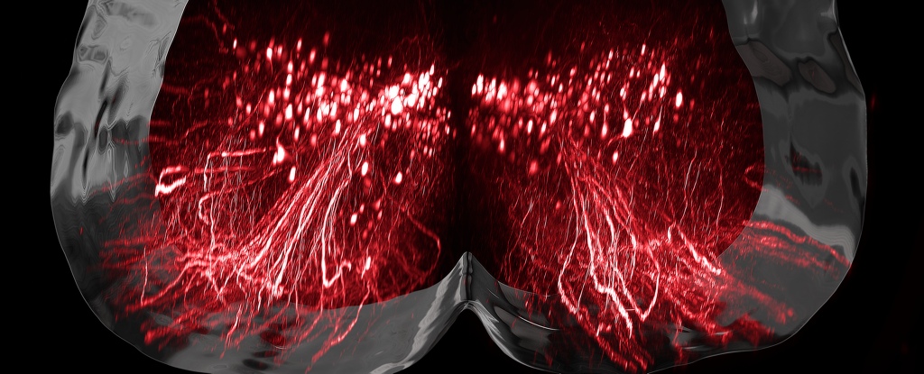 Wizualizacja neuronów, źródło: NeuroRestore