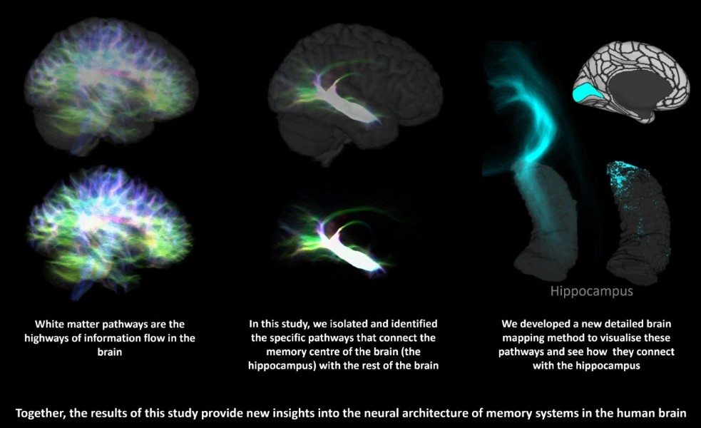 Obrazy mózgu z MRI