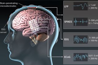 Implant mózgu (Źródło:iopscience)