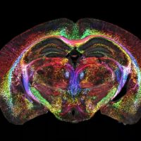 Nowy, superdokłądny obraz mózgu (Źródło: duke)
