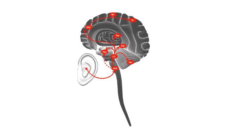 Słuchawka pobudzi nerwy do regeneracji i szybszego powrotu do zdrowia (Źródło:ethz)