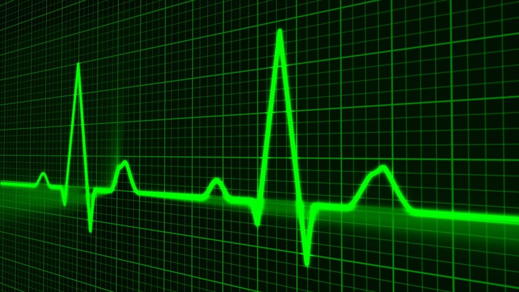 EKG, praca serca (źródło: Pixabay)