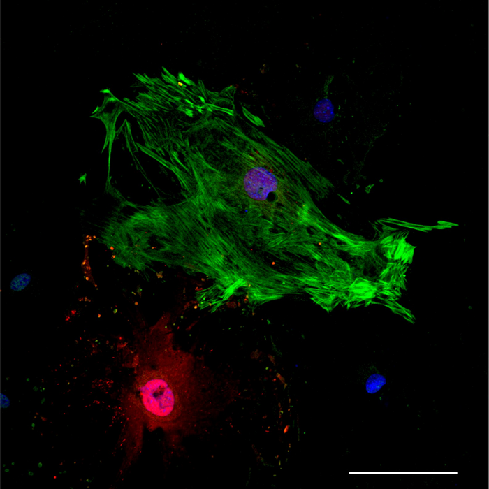 Komórki serca pochodzące z fibroblastów (Źródło: eurekalert)