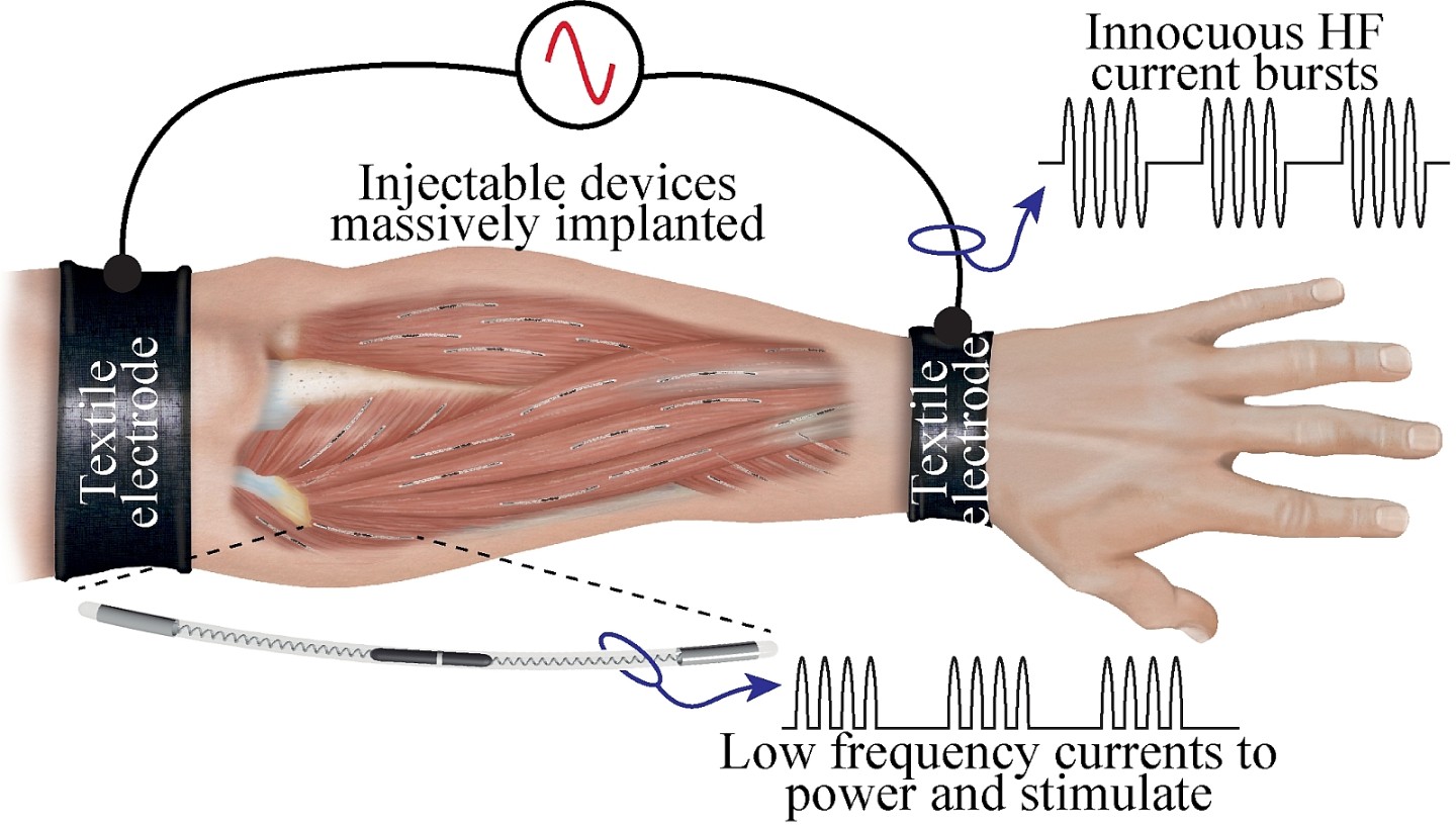 Implant do stymulowania mięśni EXTEND (Źródło: fraunhofer)