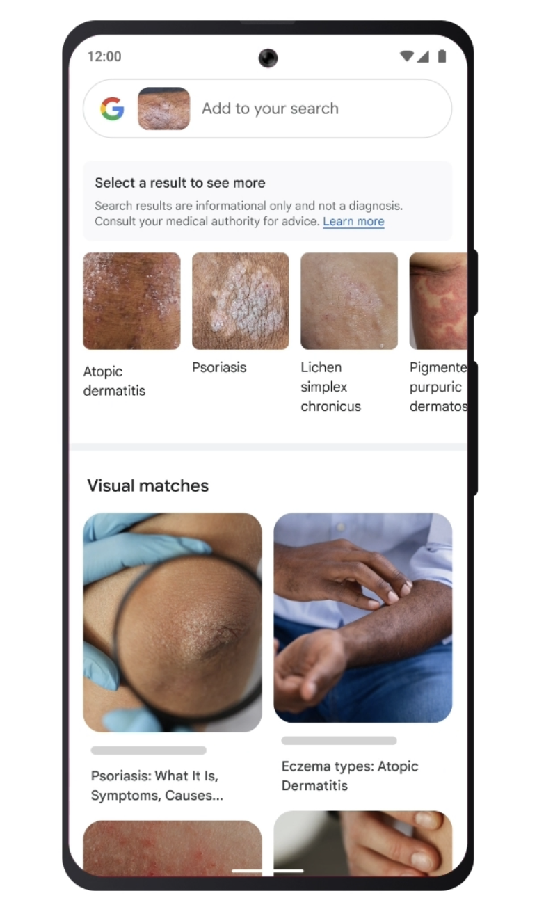 Google Lens zbada twoją skórę Oiot Pexels Skóra Pieprzyk Skin