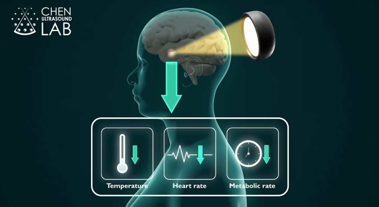 Ultradźwięki użyte do wywołania hibernacji (Źródło: wustl)