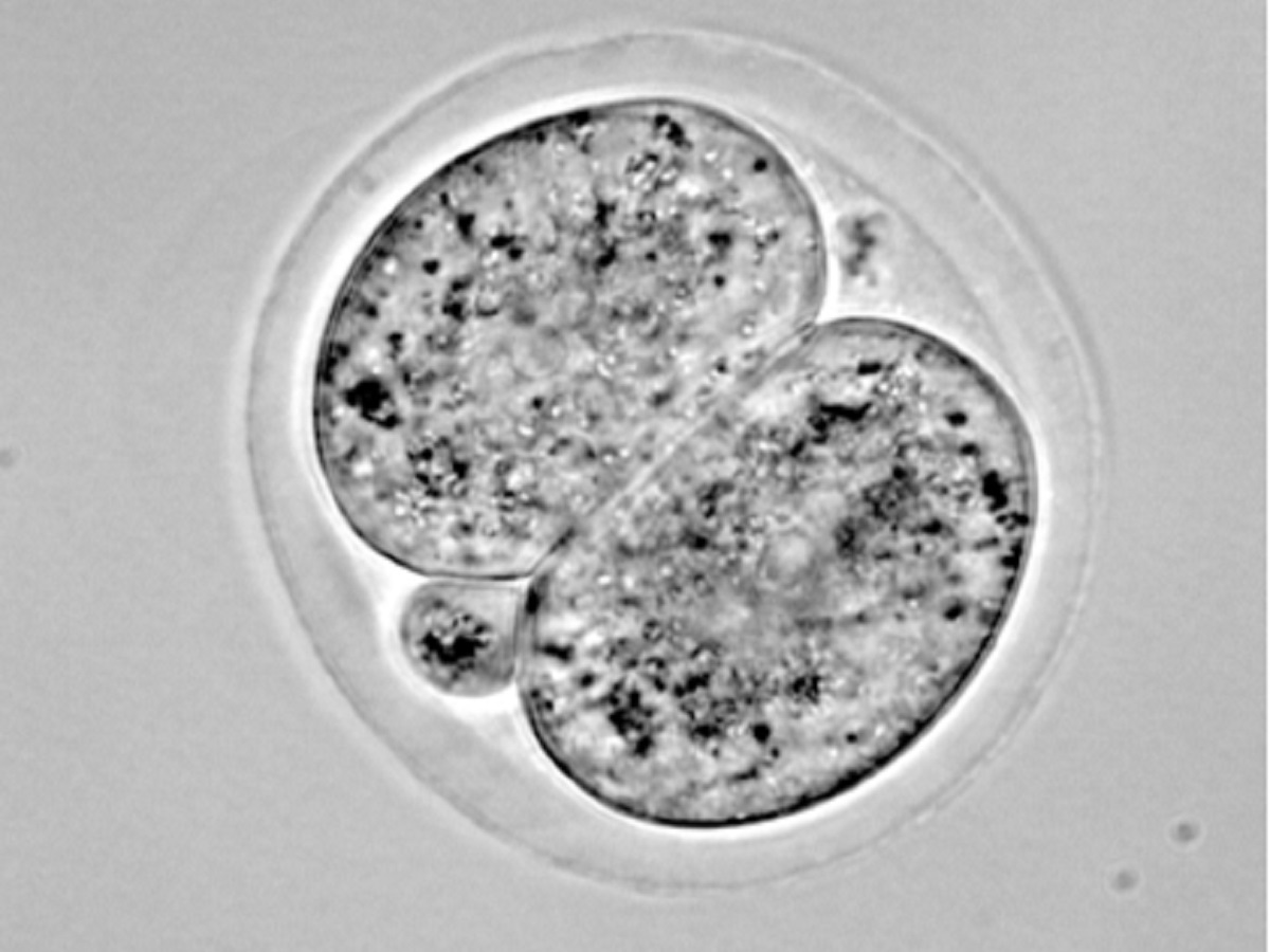 Zarodek pod mikroskopem, in vitro (źródło: University of Adelaide)
https://www.adelaide.edu.au/newsroom/news/list/2023/07/05/holograms-for-life-improving-ivf-success