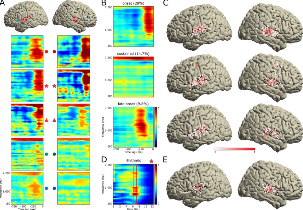 Reakcje mózgu na słuchanie muzyki (źródło: PLOS Biology)